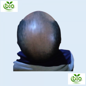 Before Applying Formula